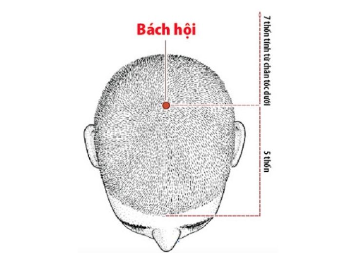 Vị trí huyệt bách hội là điểm giao nhau giữ điểm cao nhất của vành tai và giữa trán đi xuống